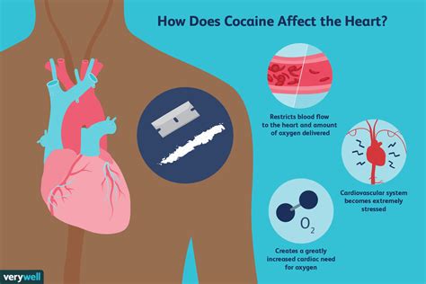 How Cocaine Affects the Cardiovascular System