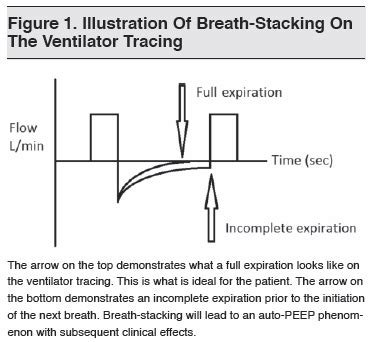 Clinical Pearls For Ventilator Management