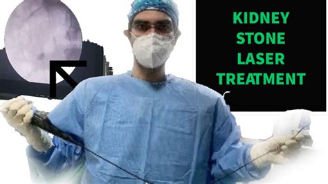 Kidney Stone Treatment in Delhi