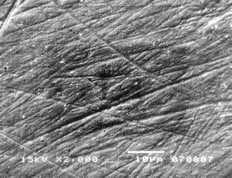 Healthy tooth enamel with tooth brush traces (x2000). | Download Scientific Diagram