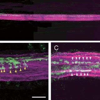 Ci-VACHT-positive neurons innervate the muscle cells in the anterior... | Download Scientific ...