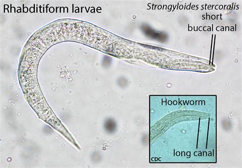 Strongyloides Stercoralis Filariform Larvae