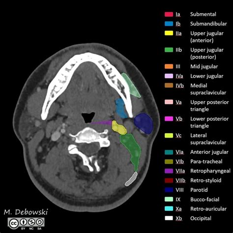 Ct Anatomy Head - Anatomical Charts & Posters