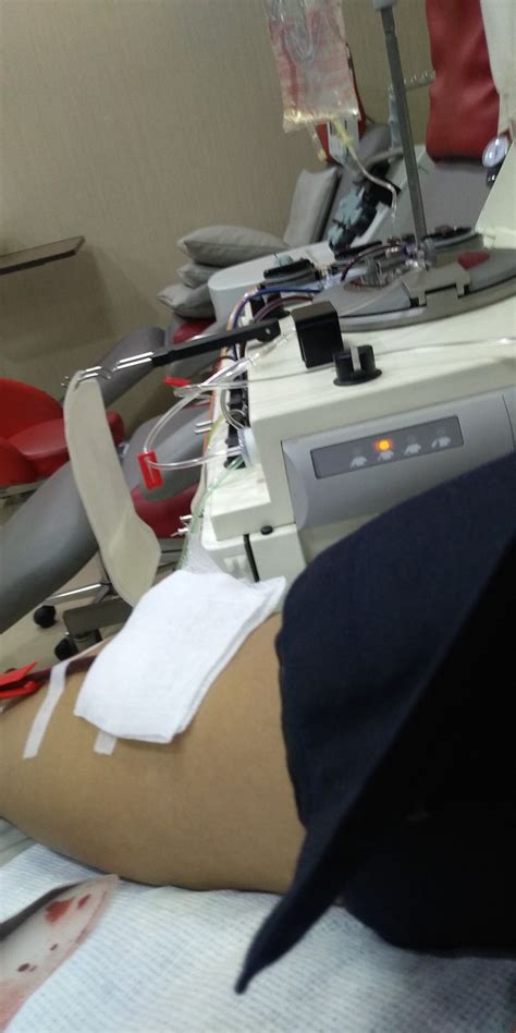 Donor apheresis pertama | Blood4Life.ID