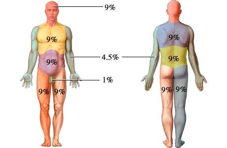 Determining Total Body Surface Area - MN Dept. of Health