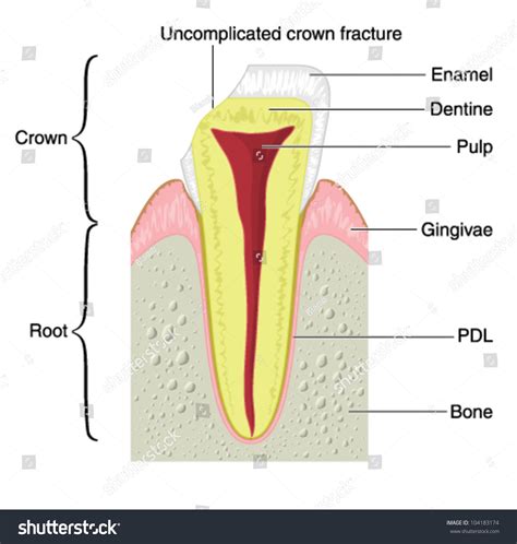 Drawing To Show The Main Anatomical Structures Of A Typical Incisor ...