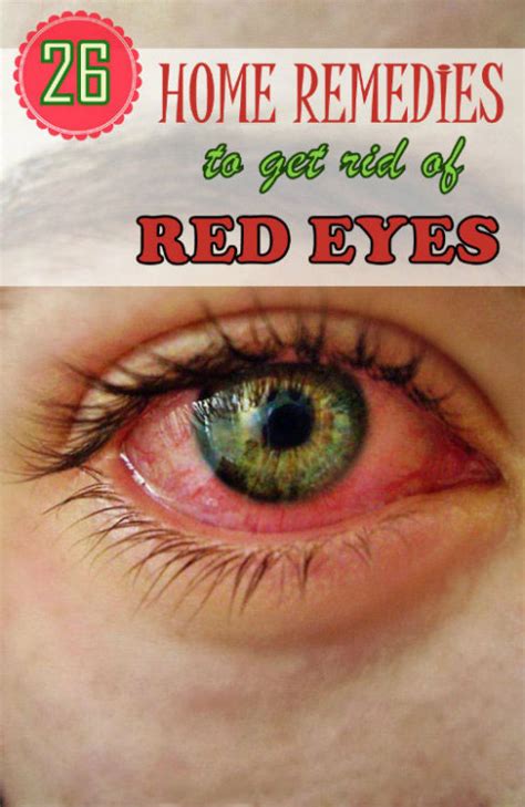 Home Remedy Hacks • 26 Effective Home Remedies to Get Rid of Red Eyes