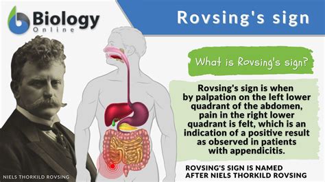 Rovsings sign Definition and Examples - Biology Online Dictionary