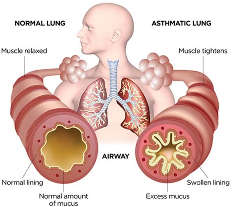 Allergy and Asthma Clinic in Abu Dhabi - Skin Allergy