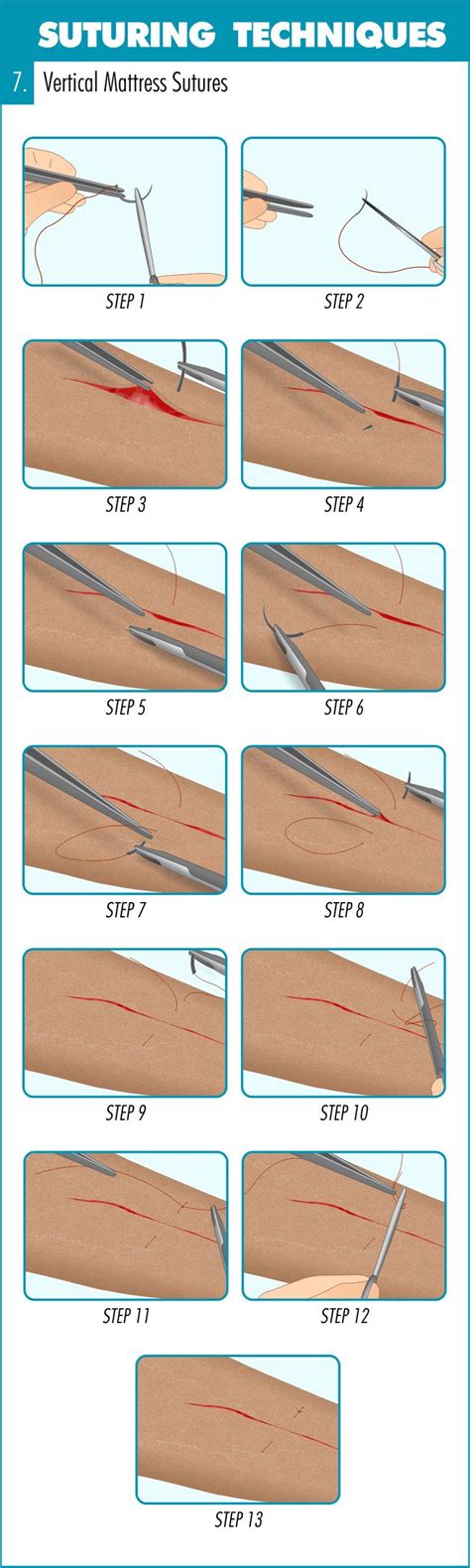 Best Mattresses of 2020 | Updated 2020 Reviews‎: Cross Mattress Suture ...