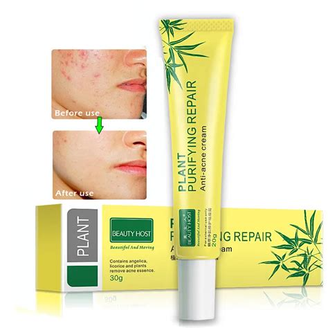 Original Acne Cream Acne Scar Treatment Anti Acne Cleaning Pimple Quickly Face Cream Acne ...