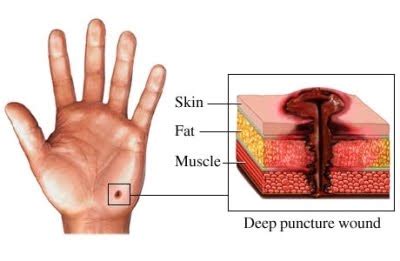 Injuries: CoMmon SkIn InJuRiEs