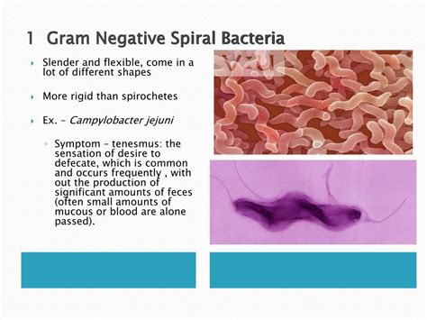 PPT - Classification of Bacteria PowerPoint Presentation, free download - ID:1250525