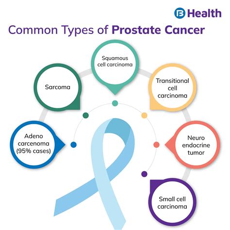 Prostate Cancer: Symptoms, Causes and Treatment