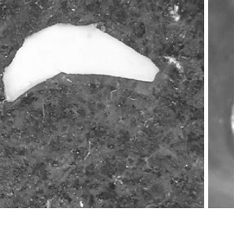 a Semilunar shaped cartilage. b Post operative microscopic photograph | Download Scientific Diagram