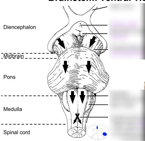 ventral brain stem Diagram | Quizlet