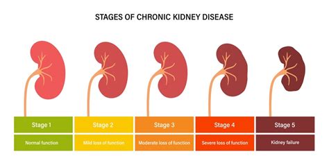 Chronic Kidney Disease – Causes, Symptoms, Treatments