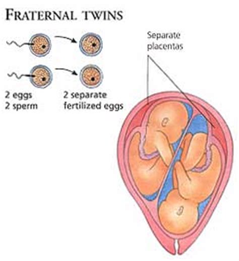 Twin Terminology | Think About It