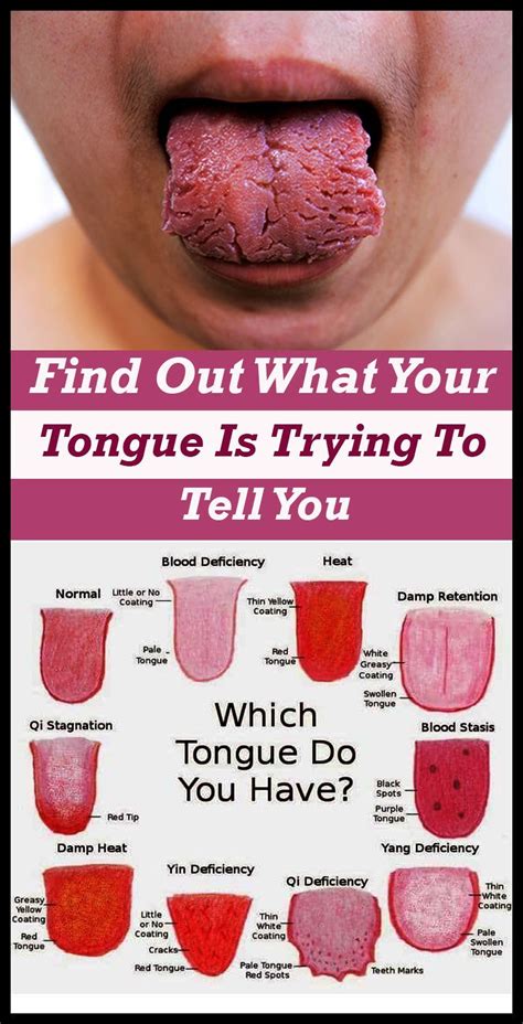 How To Heal A Cut Tongue - Heal Info