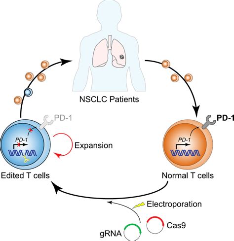 A New CRISPR Cancer Treatment Has Been Tested On Humans For