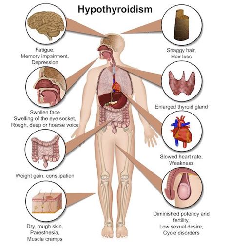 Thyroid Disease: 20 Symptoms | The Surgical Clinic