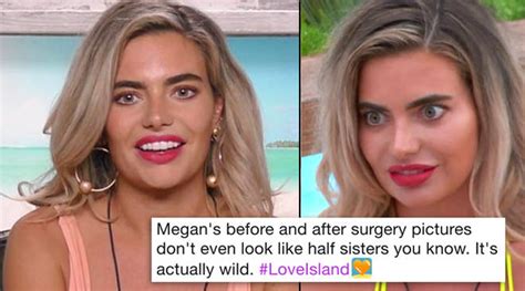 Megan From "Love Island's" Before And After Plastic Surgery Pics Have Surfaced - PopBuzz