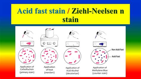 Ziehl Neelsen Stain Acid Fast Staining Test Acid Fast, 57% OFF