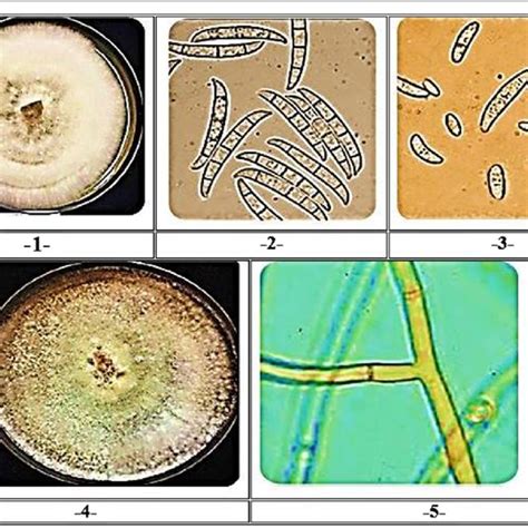 In vitro interactions of Macrophomina phaseolina with fungi and ...