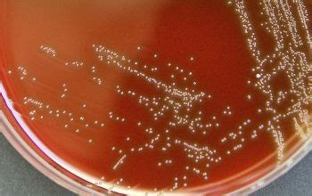 Aerococcus urinae