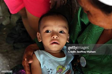 Filipino Children Suffer From Severe Malnutrition Photos and Premium High Res Pictures - Getty ...