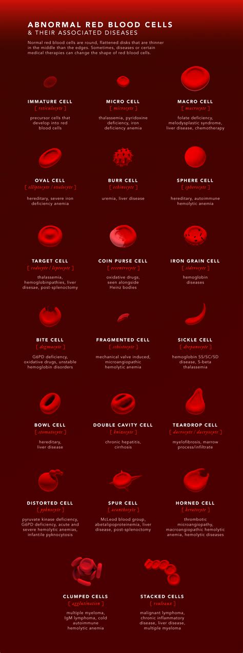 What Causes Irregular Shaped Blood Cells at Julio Levine blog