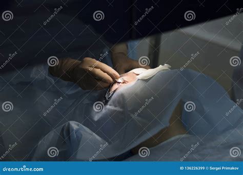 Laser Surgery for Vision Correction Stock Image - Image of hospital, lens: 136226399