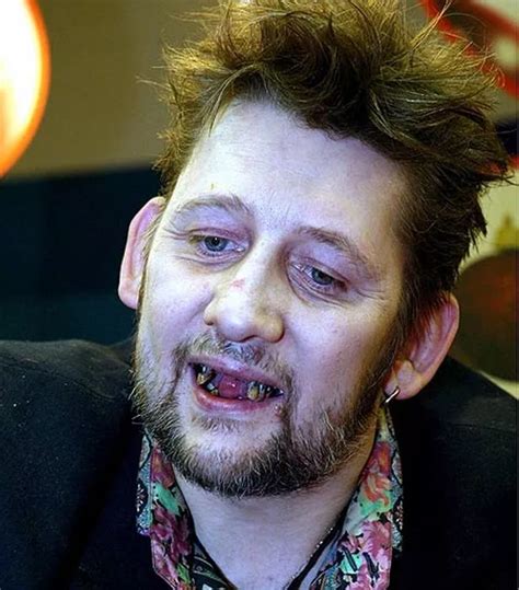 Fairytale of new TEETH! Shane MacGowan displays impressive new gnashers at charity bash - Irish ...