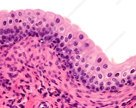 Transitional Epithelium Tissue