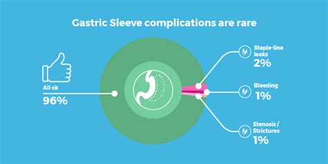 Gastric Sleeve Complications & Side Effects - The 5 Most Common - Bariatric Surgery Source