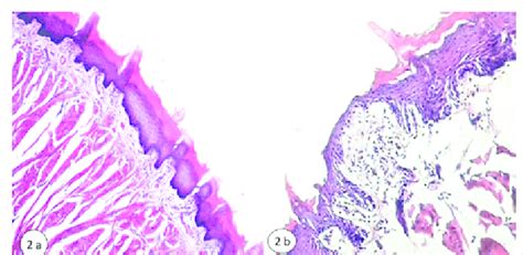 Photomicrographs of the dorsal tongue surface of the OVX+P group ...