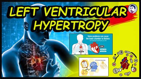 What is Left Ventricular Hypertrophy | Causes | Treatments | Complications | English | 2022 ...