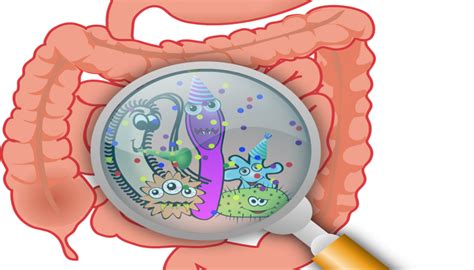 Disease clipart cholera, Disease cholera Transparent FREE for download on WebStockReview 2023