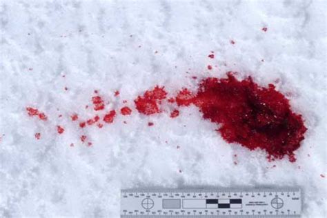 Bloodstain Pattern Analysis in Snow – Examination of Bloodstain Patterns in Icy and Soft Powder ...