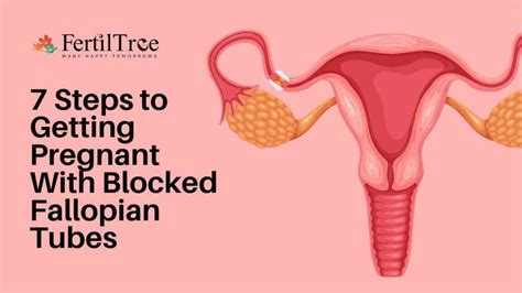 7 Steps to Getting Pregnant With Blocked Fallopian Tubes