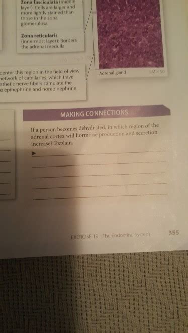 Solved Zona fasciculata (middle layer) Cells are larger and | Chegg.com