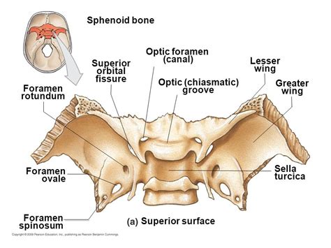 Sphenoid Bone Optic Foramen