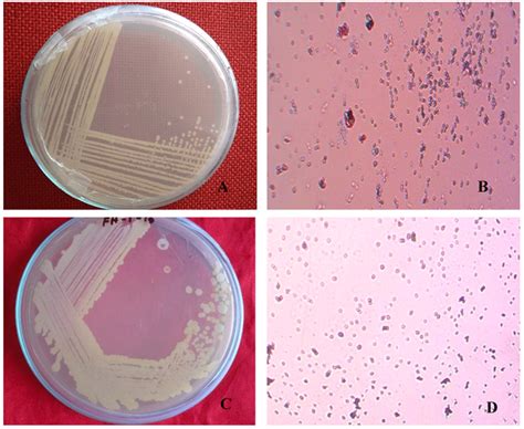 Serratia Marcescens Under Microscope