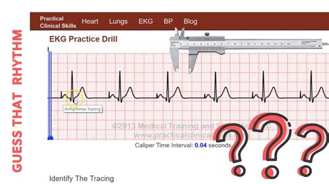 GUESS THAT RHYTHM: ATRIAL-PACED - YouTube