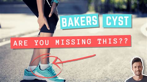 Bakers Cyst Exercises You Probably Aren’t Doing (But Absolutely Should – Your Wellness Nerd