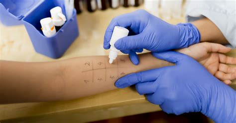 Allergy Testing: What it is and What to Expect | GMP Medical | Hialeah