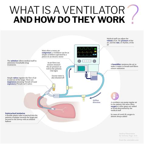 What Is A Ventilator And How Do They Work? | Ventilator Diagram