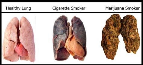 Healthy vs Smokers Lungs : r/trees