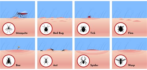 Insects That Bite or Sting: Iowa's Most Common Bug Bites