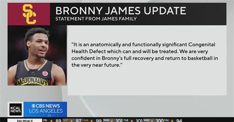 Bronny James health update: Congenital heart defect - CBS Los Angeles